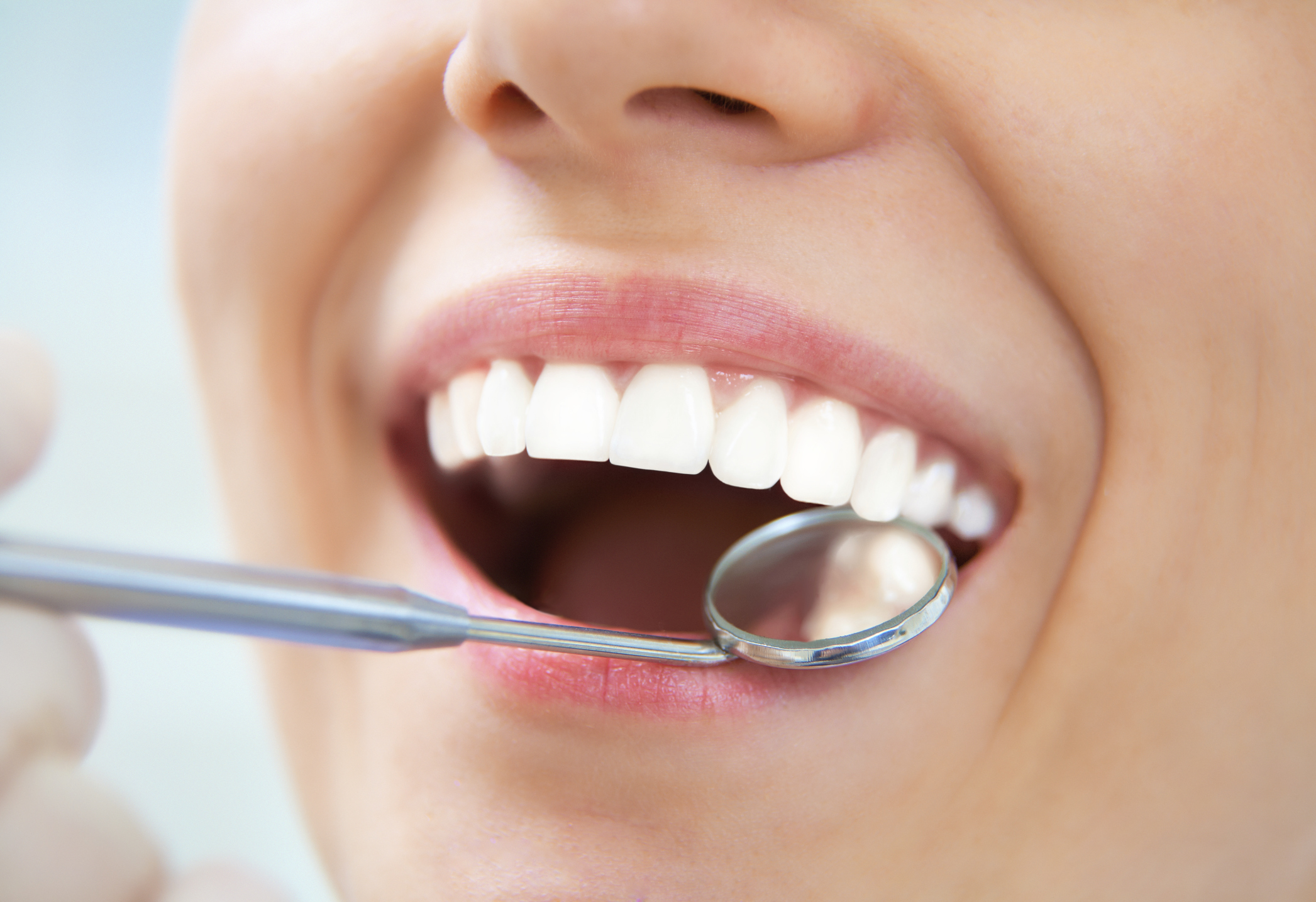 4 Types of Cosmetic Dental Procedures