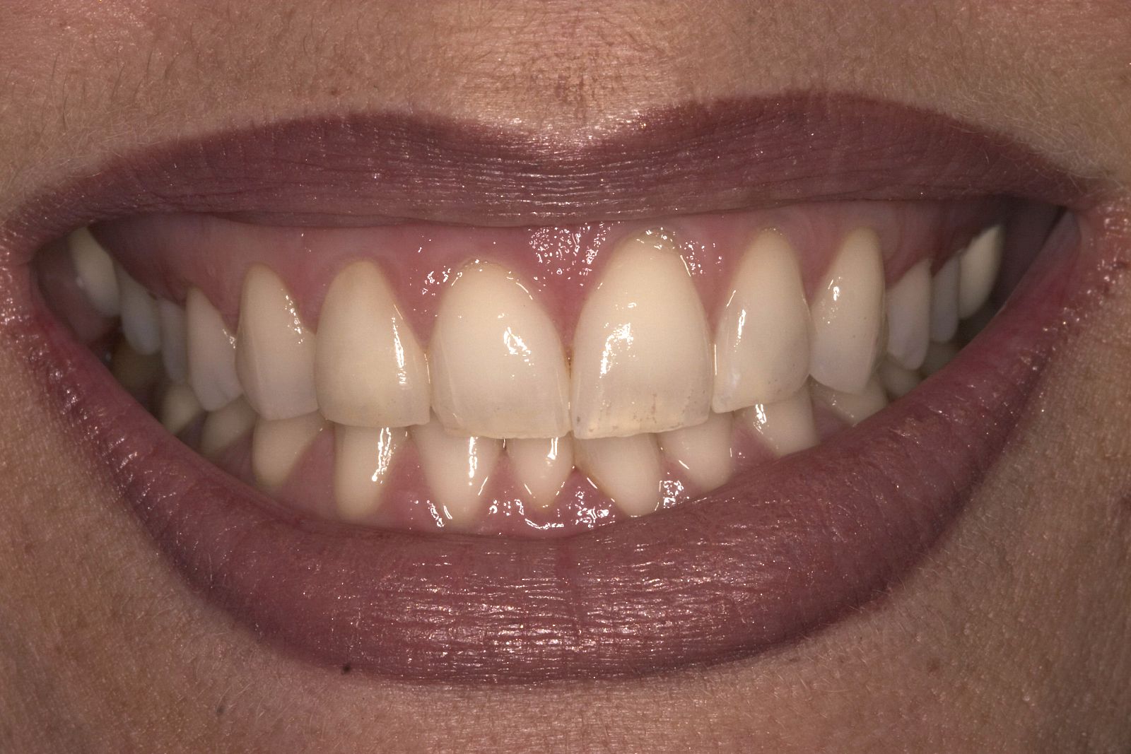 Dentum - Aesthetic dentistry